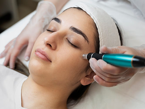 Microdermabrasion